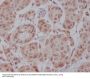Anti-AKT1 Monoclonal Antibody