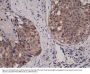 Anti-Akt1 Rabbit Monoclonal Antibody, Clone#RM252