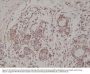 Anti-AKT (PH domain) AKT1 Rabbit Monoclonal Antibody, Clone#RM316