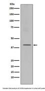 Anti-CXCR4 Monoclonal Antibody
