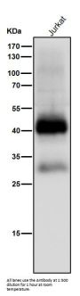 Anti-CXCR4 Monoclonal Antibody