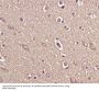 Anti-BDNF Rabbit Monoclonal Antibody