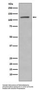 Anti-Phospho-Retinoblastoma (S780) RB1 Rabbit Monoclonal Antibody