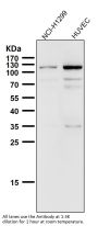 Anti-Rb RB1 Rabbit Monoclonal Antibody