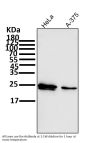 Anti-Bcl-2 Rabbit Monoclonal Antibody