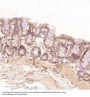 Anti-Bcl-2 Rabbit Monoclonal Antibody