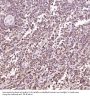 Anti-Bcl-2 Rabbit Monoclonal Antibody