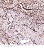 Anti-Bcl-2 Rabbit Monoclonal Antibody