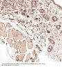 Anti-Bcl-2 Rabbit Monoclonal Antibody