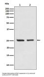 Anti-Bcl-2 Rabbit Monoclonal Antibody