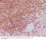 Anti-Bcl-2 Rabbit Monoclonal Antibody