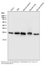 Anti-Bcl-2 Rabbit Monoclonal Antibody