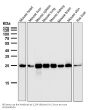 Anti-Bcl-2 Rabbit Monoclonal Antibody