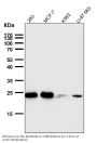 Anti-Bcl-2 Rabbit Monoclonal Antibody