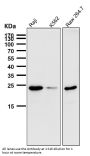 Anti-Bcl-2 Rabbit Monoclonal Antibody