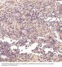 Anti-Bcl-2 Rabbit Monoclonal Antibody