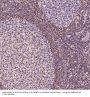 Anti-Bcl-2 Rabbit Monoclonal Antibody