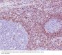 Anti-Bcl-2 Rabbit Monoclonal Antibody