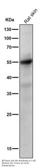 Anti-Caspase-8 CASP8 Rabbit Monoclonal Antibody