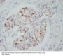 Anti-VEGF VEGFA Rabbit Monoclonal Antibody
