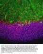 Anti-MeCP2 Antibody