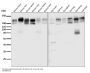 Anti-P Glycoprotein ABCB1 Rabbit Monoclonal Antibody
