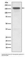 Anti-P Glycoprotein ABCB1 Rabbit Monoclonal Antibody