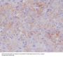 Anti-P Glycoprotein ABCB1 Rabbit Monoclonal Antibody