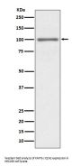 Anti-KMT6 / EZH2 Rabbit Monoclonal Antibody