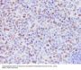 Anti-KMT6 / EZH2 Rabbit Monoclonal Antibody