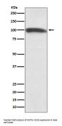 Anti-KMT6 / EZH2 Rabbit Monoclonal Antibody