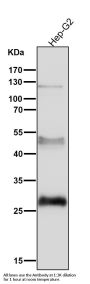 Anti-Sonic Hedgehog SHH Rabbit Monoclonal Antibody