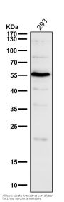 Anti-Smad3 Rabbit Monoclonal Antibody