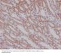 Anti-Smad3 Rabbit Monoclonal Antibody