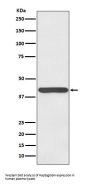 Anti-Haptoglobin HP Rabbit Monoclonal Antibody