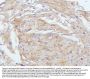 Anti-E Cadherin 1 CDH1 Antibody Picoband® (monoclonal, 9G2)