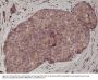 Anti-E-Cadherin 1 (CDH1) Rabbit Monoclonal Antibody, Clone#RM244