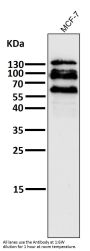 Anti-E Cadherin Rabbit Monoclonal Antibody