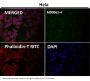 Anti-E Cadherin Rabbit Monoclonal Antibody