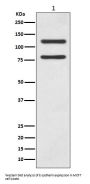 Anti-E Cadherin Rabbit Monoclonal Antibody