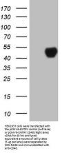 Anti-CD40 Mouse Monoclonal Antibody [Clone ID: OTI8B8]
