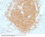 Anti-CD40 / TNFRSF5 Monoclonal Antibody