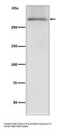Anti-Dystrophin DMD Rabbit Monoclonal Antibody