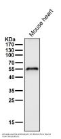 Anti-Aromatase CYP19A1 Rabbit Monoclonal Antibody