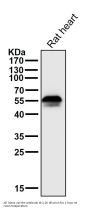 Anti-Aromatase CYP19A1 Rabbit Monoclonal Antibody