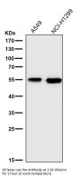 Anti-Aromatase CYP19A1 Rabbit Monoclonal Antibody