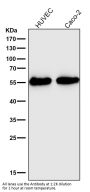 Anti-Aromatase CYP19A1 Rabbit Monoclonal Antibody
