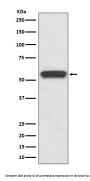Anti-Aromatase CYP19A1 Rabbit Monoclonal Antibody