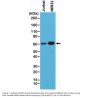 Anti-Smad4 Rabbit Monoclonal Antibody, Clone#RM277