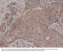 Anti-Smad4 Rabbit Monoclonal Antibody, Clone#RM277